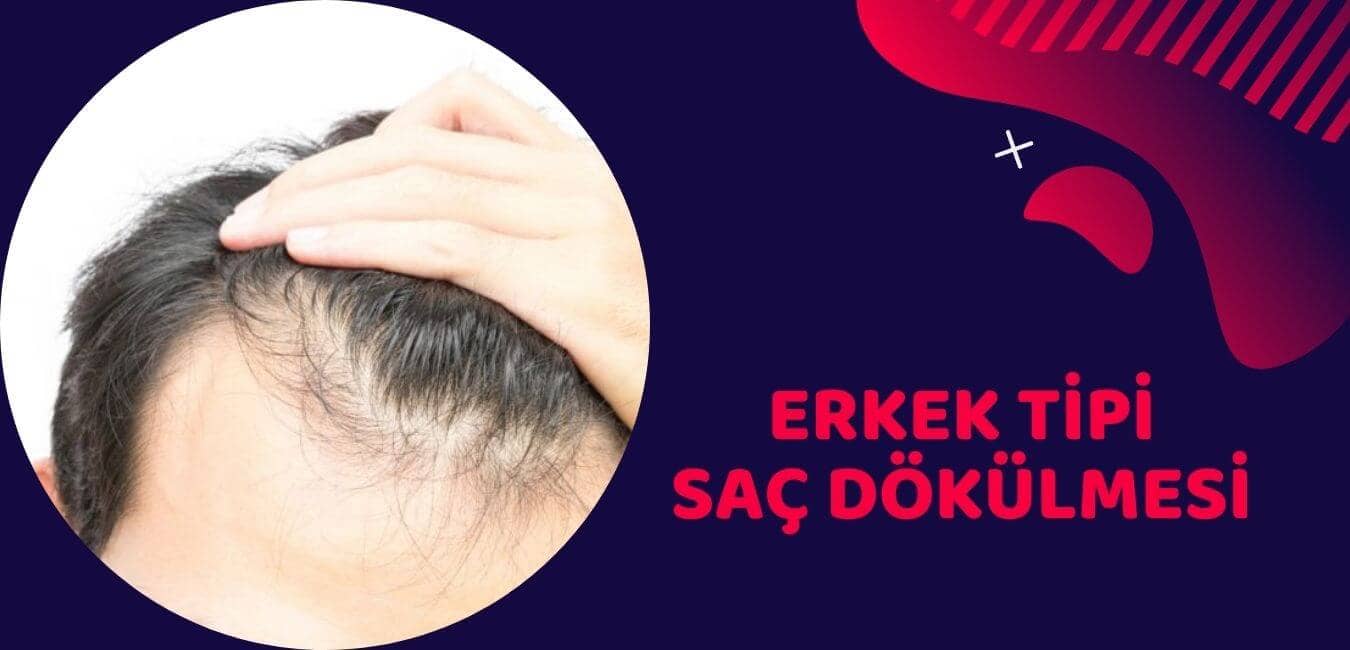 saç dökülmesi