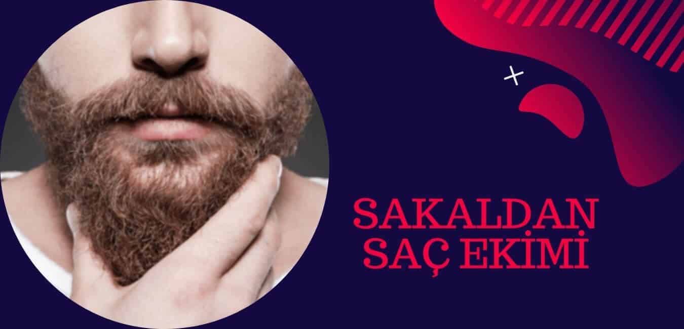 sakal kıllarından saç ekim