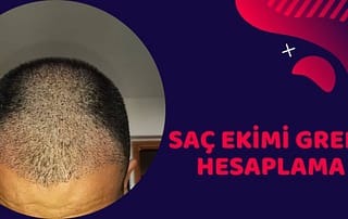 greft hesaplama nasıl yapılır